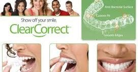 Invisalign & ClearCorrect- Invisible Braces FAQ