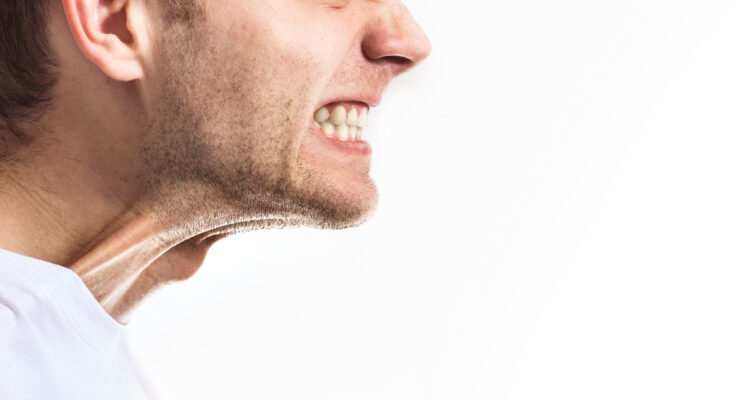 Bruxism or grinding clenching can cause a painful jaw & headaches