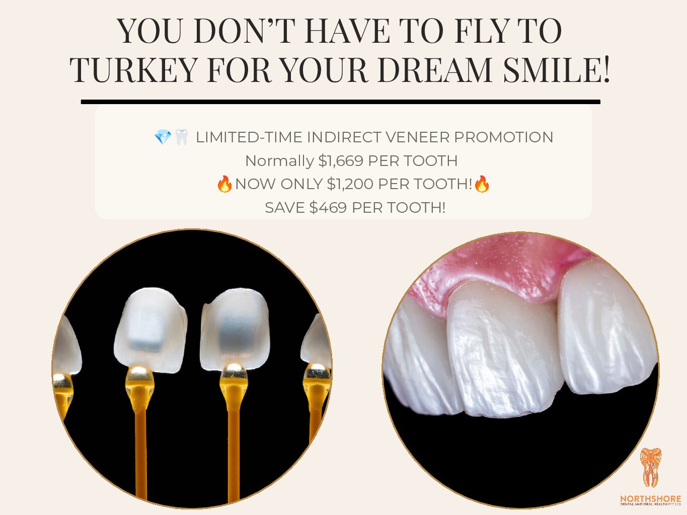 YOU DON’T HAVE TO FLY TO TURKEY FOR YOUR DREAM SMILE!