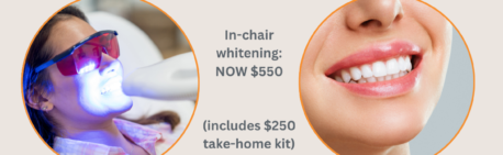 Give your smile some extra attention with professional teeth whitening
